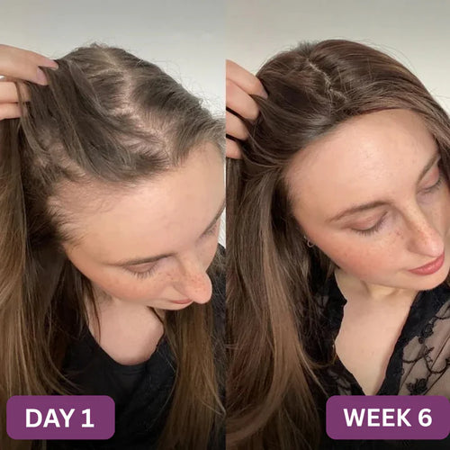 Hair Growth Soft Chews