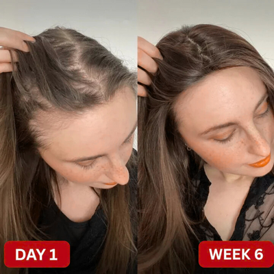 Hair Growth Candy Soft Chews